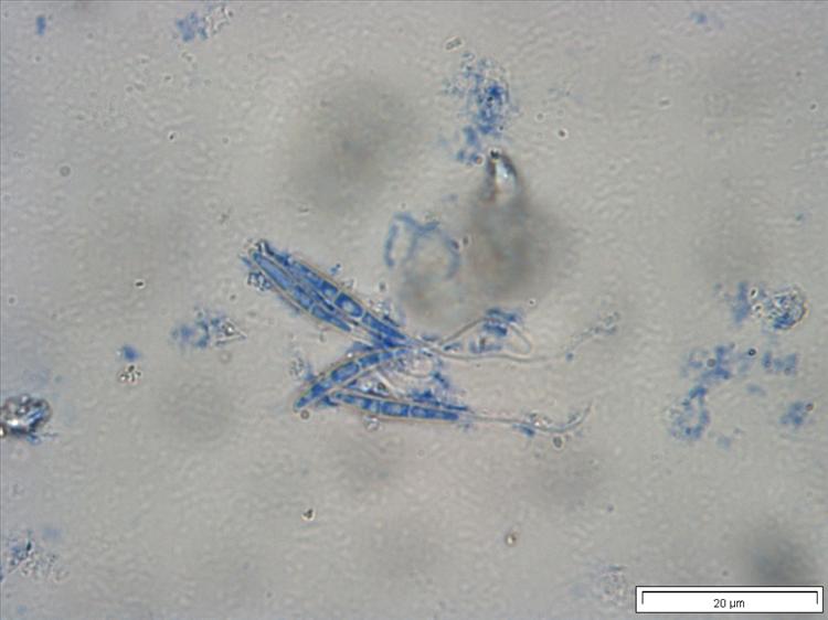 Graphidastra muriformis from Malaysia tailed ascospores